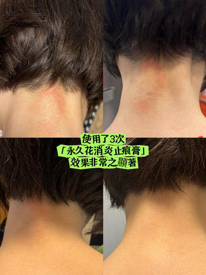 永久花驅蚊消炎止痕膏